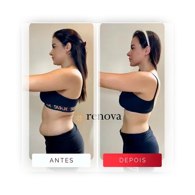 Prancheta 14-1 Média