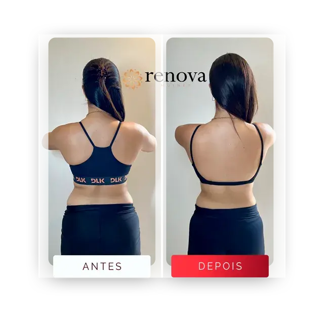 Prancheta 14 copiar-1 Média