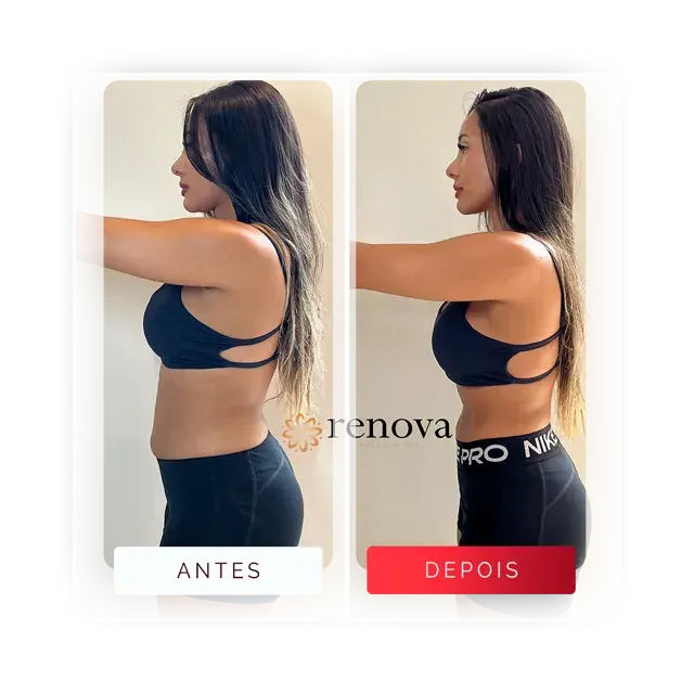 Prancheta 14 copiar 7 Média