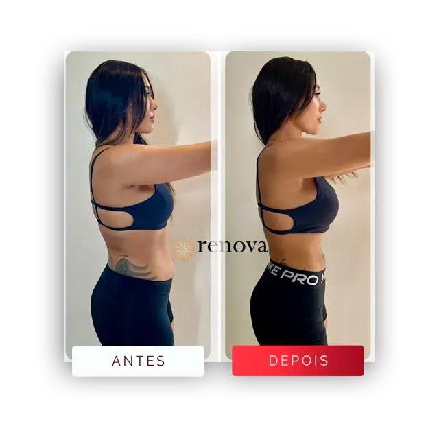 Prancheta 14 copiar Média